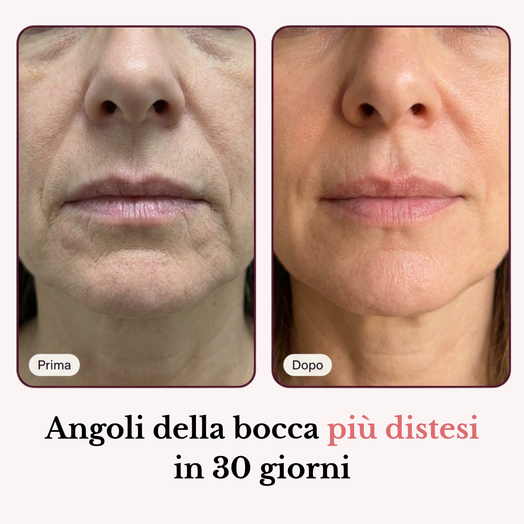 Stick Balsamo Rimpolpante