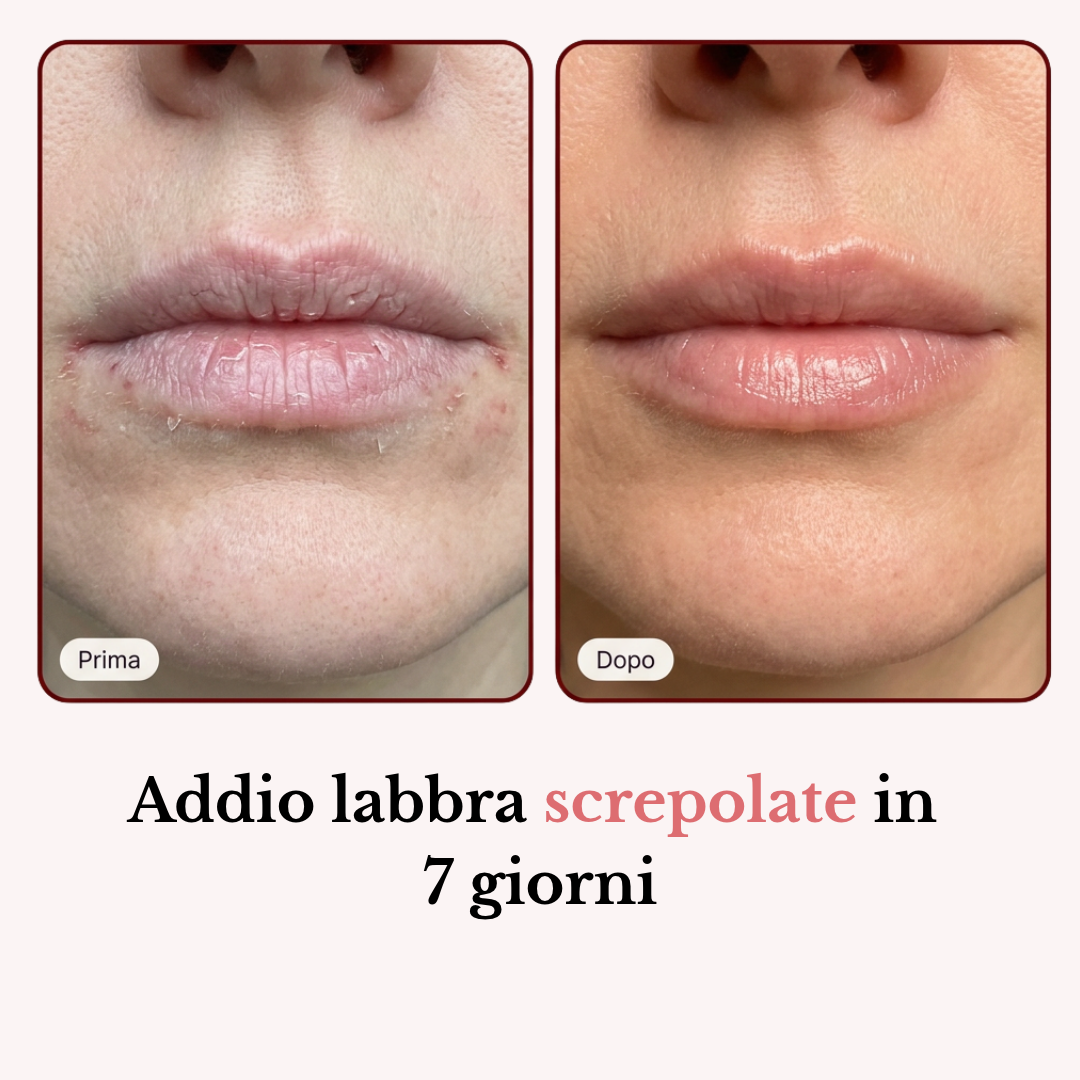 Stick Balsamo Rimpolpante