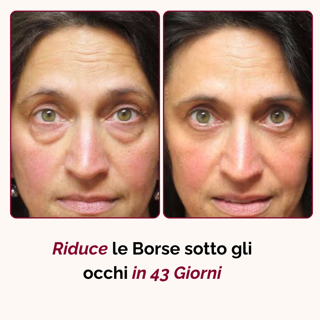 Stick Balsamo Rimpolpante