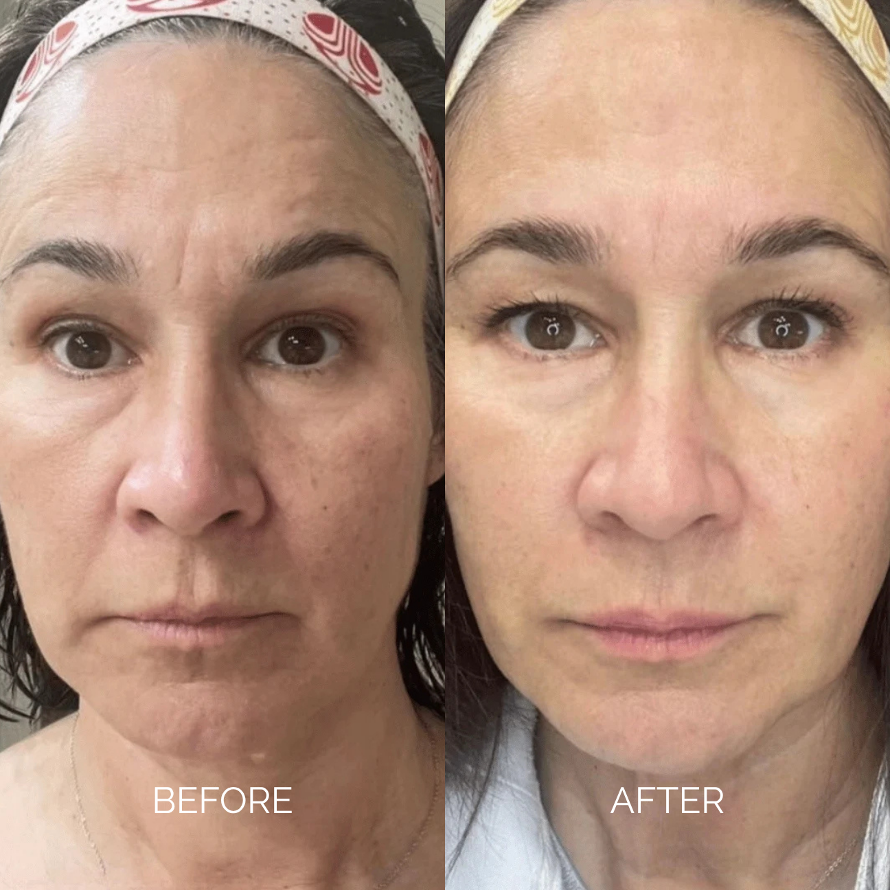 Sodium DNA Anti-Age Cream