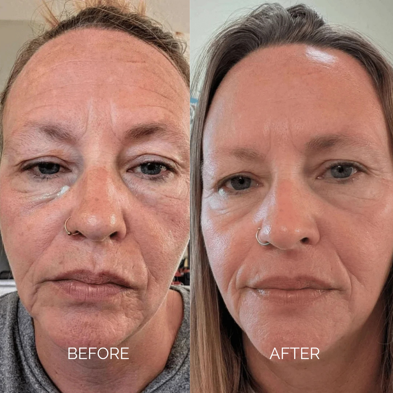 Sodium DNA Anti-Age Cream