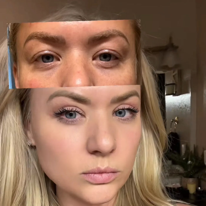 Anna Laura, 42