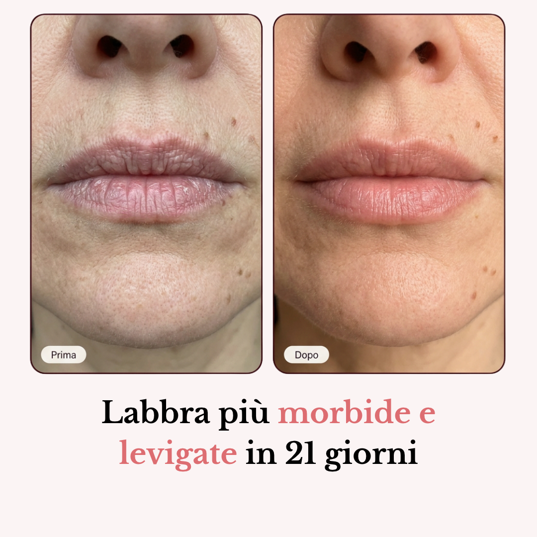 Stick Balsamo Rimpolpante