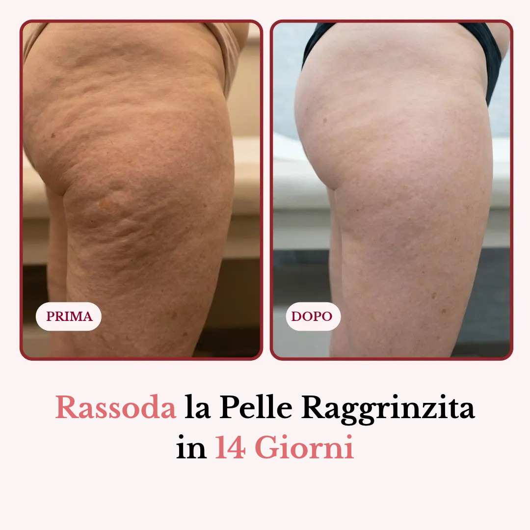 Stick Balsamo Rimpolpante Pelle Crespa