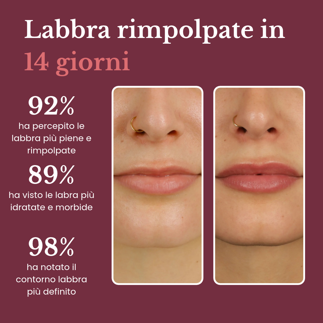 Stick Balsamo Rimpolpante