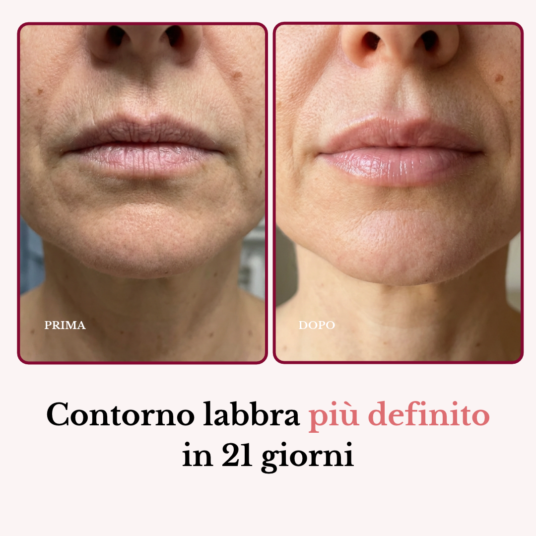 Stick Balsamo Rimpolpante